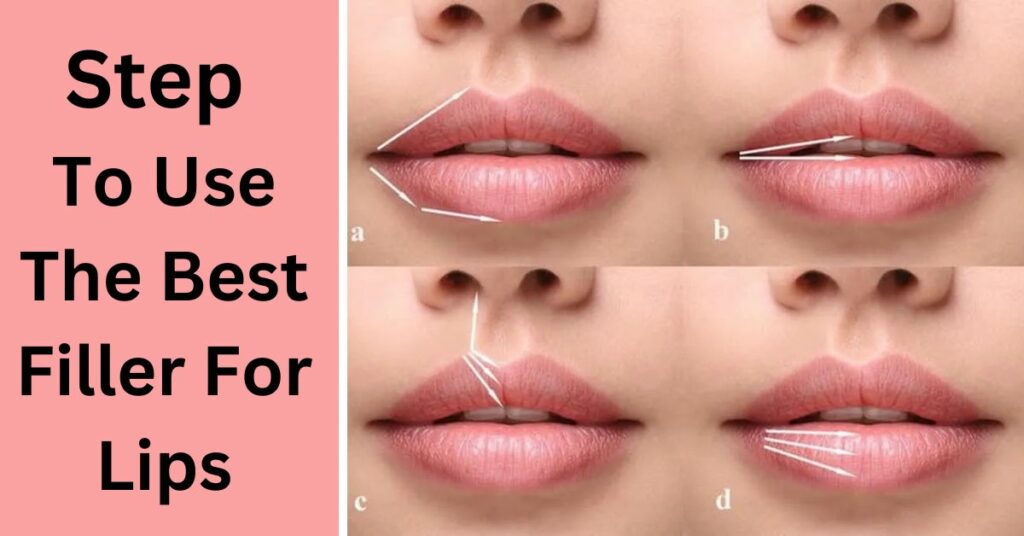 Step to use the best filler for lips