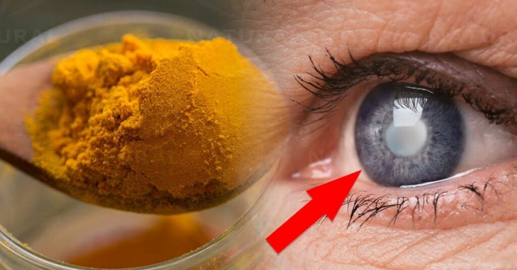 Turmeric- Beneficial in the treatment of cataracts  