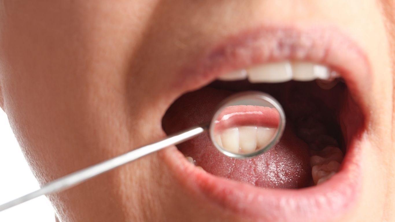 Best Natural Gum Care