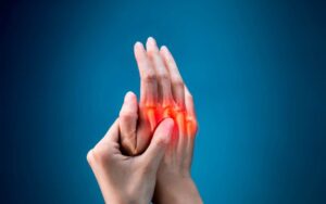 Best Supplements for Arthritis