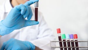 10 Daily Habits for Stable Blood Sugar