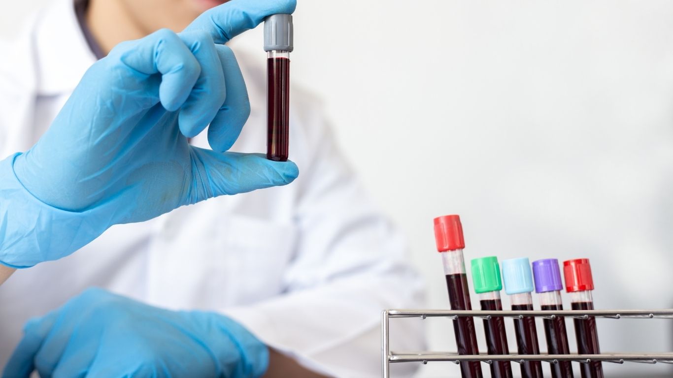 10 Daily Habits for Stable Blood Sugar